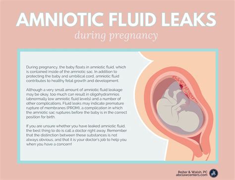 is amniotic fluid sticky|Leaking amniotic fluid